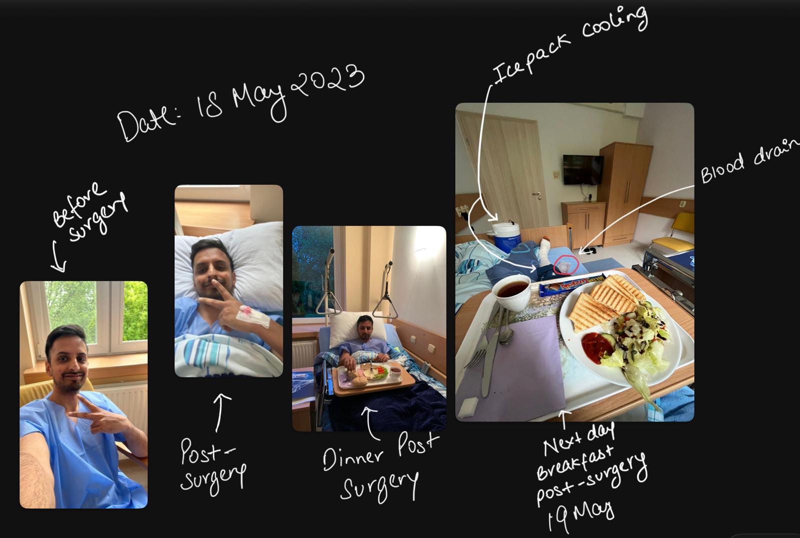 Surgery Day