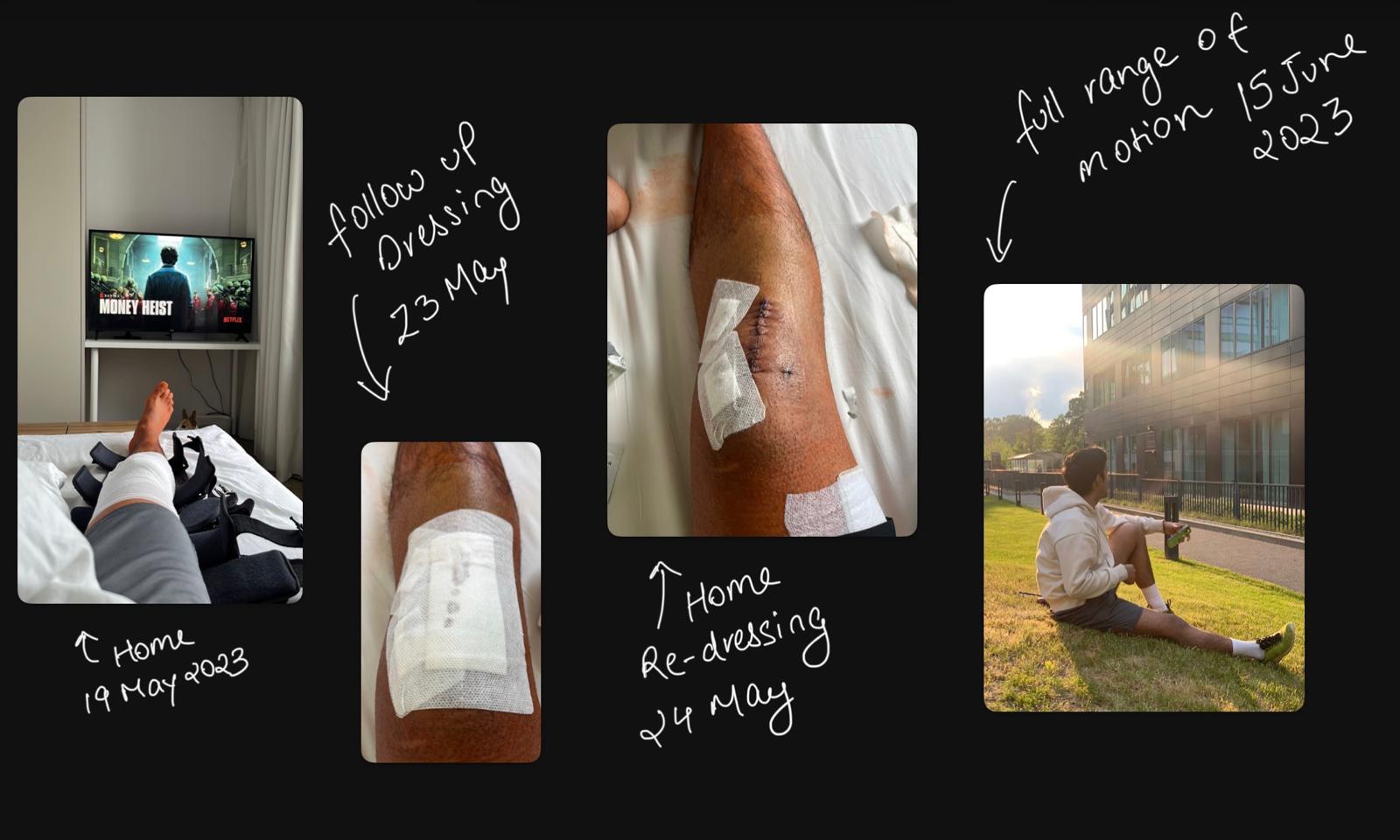 Recovery from surgery